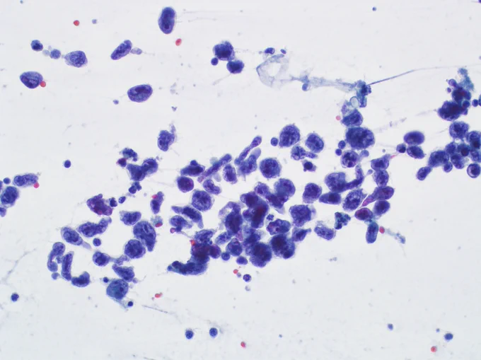 Pap stained smear