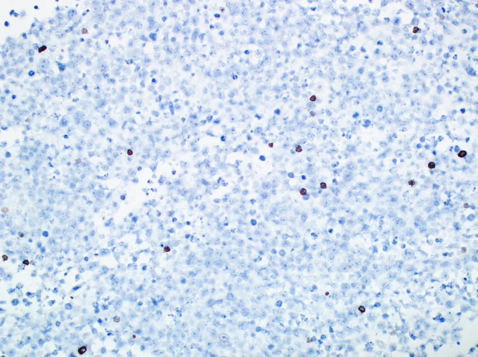 CD20