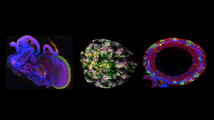 These are microscope images of organoids used in research