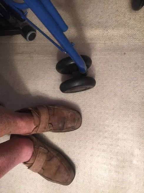 Legs   feet (old, swollen) in leather shoes, next to walker
