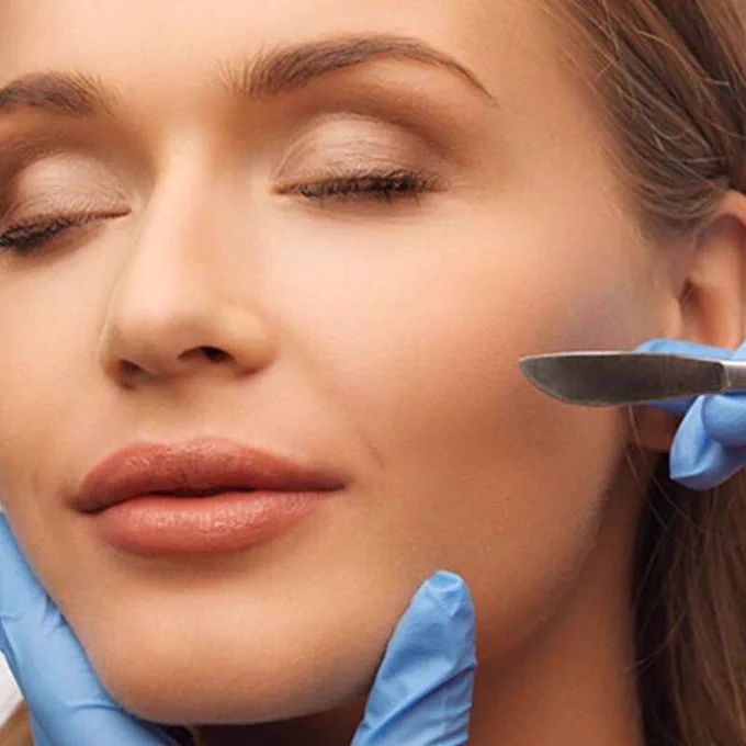 ✔️WHAT IS IT: Dermaplaning is a method of exfoliation that consists of using a scalpel to gently scrape off the top layer of dulling dead skin cells in order to reveal a smoother complexion.
✔️WHO SHOULD DO IT: It’s great for all skin types. 
✔️DISCOMFORT: None
✔️SOCIAL DOWNTIME: None