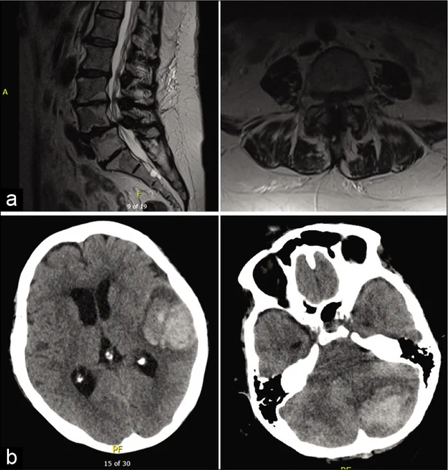 Case 1