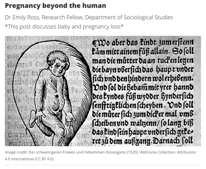 Line drawing and text depicting pregnancy from a sixteenth century medical textbook