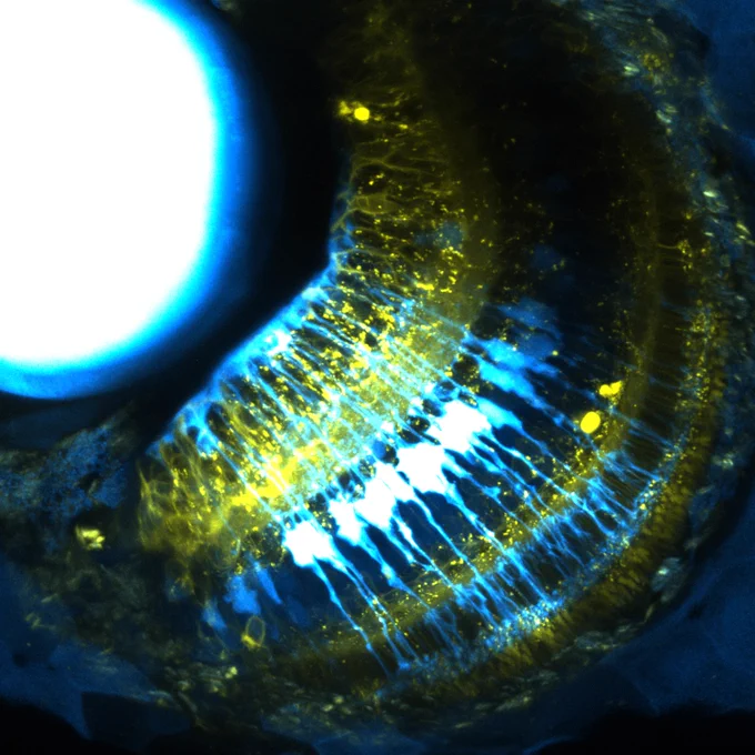 The image shows the intricate relationship of neurons (yellow) and Müller glia support cells (cyan) in the eye of a 4.5 day old zebrafish.