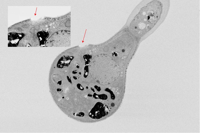 Electron microscope imaging of Dionysia tapetodes glandular trichome head showing wool exit site. Images by Matthieu Bourdon and Karin Müller.