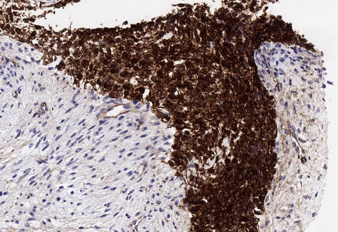 Beta-catenin
