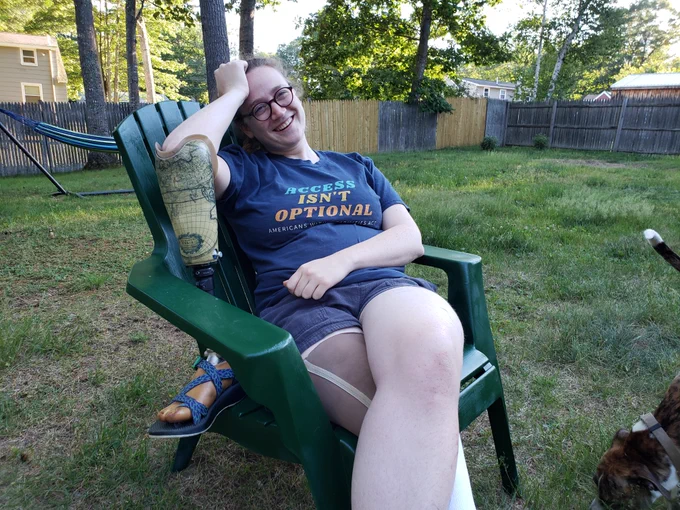 a picture of Sophie Poost a white woman posing in a blue t-shirt that reads "Access Isn't Optional Americans with Disabilities Act 1990-2021". Sophie is siting in a green Adirondack chair with her head propped on her elbow which rests on her prosthetic leg beside her in the chair. In the background is a grassy lawn with a few trees and a wooden fence. 