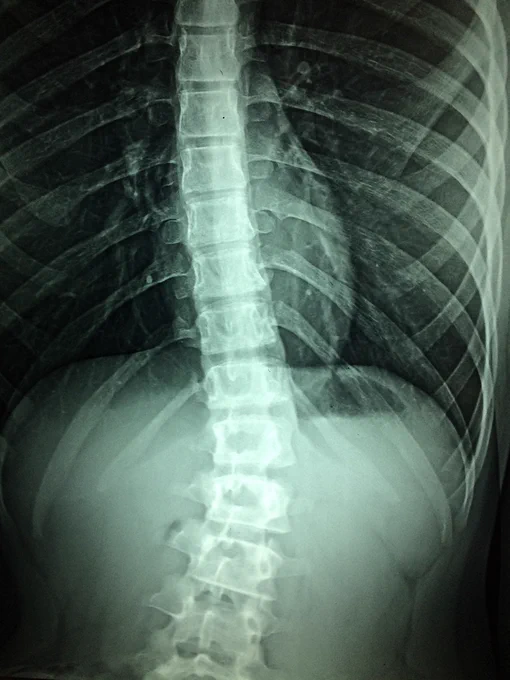 x-rays, hospital, disability