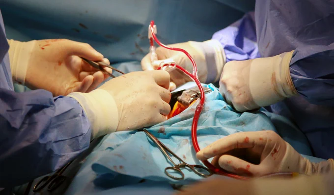 Photo of valve replacement heart surgery