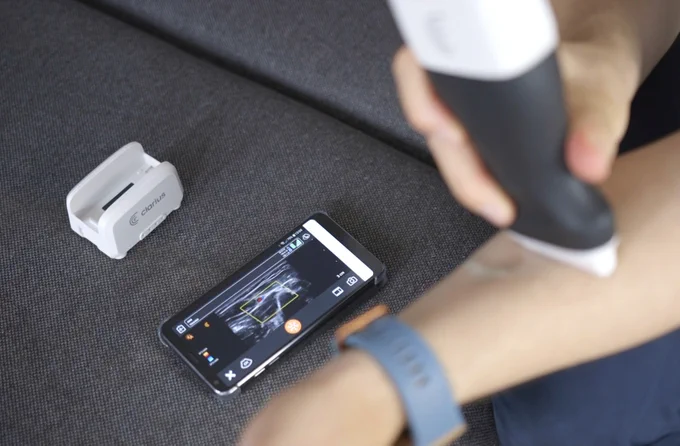 Testing Clarius, the portable, A.I.-assisted ultrasound device