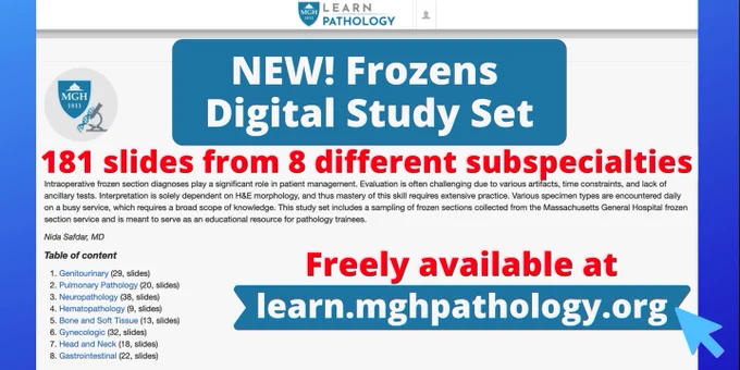 New Frozens Digital Study Set