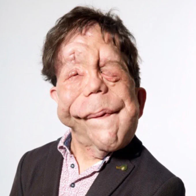Presenter and campaigner Adam Pearson