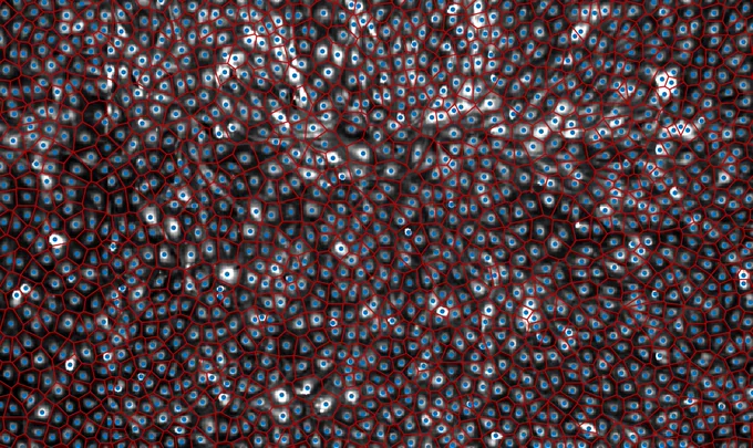 DeepScratch detects cells accurately while Voronoi tessellation provides approximate segmentation
