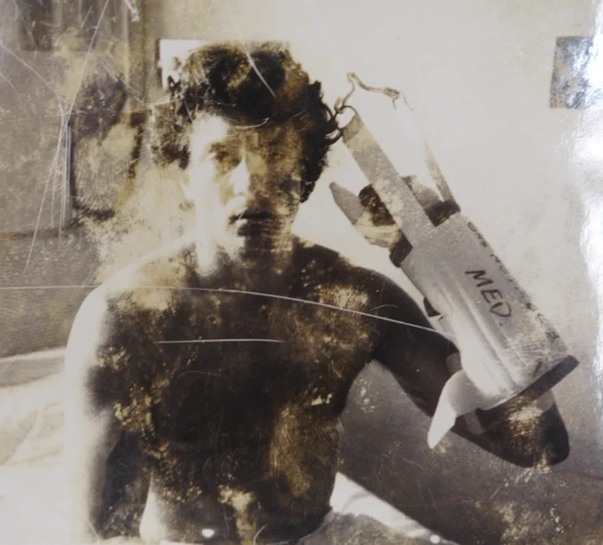 A rare photo of serial killer Ted Bundy wearing a cast. Courtesy King County archives