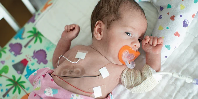 Prof. John Rogers’ battery-free, wireless sensors monitor a newborn’s vital signs. 