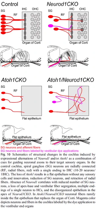 Schematics of structural changes in the cochlea induced by
expressional alternations of Neurod1 and/or Atoh1 as a combination of
cues for guiding neuronal axons to their target sensory organs. In the
control cochlea, spiral ganglion (SG) neurons are radially connected
(RF, radial fibers, red) with a single ending to IHC (10-20 neurons/
1IHC). The loss of Atoh1 results in a flat epithelium without any sensory
cells and innervation, reduction of SG neurons, and retraction of radial
fibers. Absence of Neurod1 correlates with reduced number of SG neurons,
a loss of apex-base and vestibular fiber segregation, multiple endings
of a single neuron to HCs, and the disorganized epithelium in the
apex of Neurod1CKO. In Atoh1/Neurod1CKO neuronal fibers ramify
inside the flat epithelium that replaces the organ of Corti. Magenta color
depicts neurons and fibers in the cochlea labeled by the dye application to
the vestibular end organs.