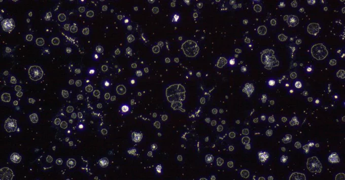 Cast Iron Sample 100x taken in dark field illumination after preparation by Aka-Brief method 14 from Akasel. Find it here: https://bit.ly/AkaBrief14