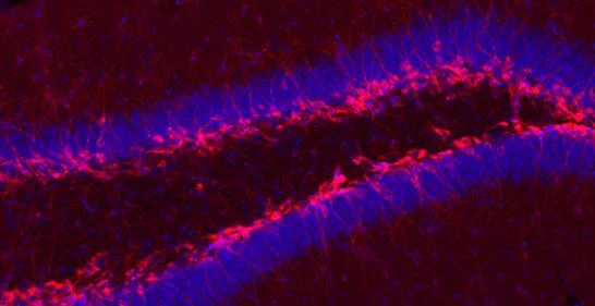 Image of neurons in blue tinged with pink and the red behind