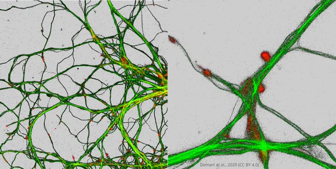 Neuronal dendrites with proteins labelled in green and red showing their responses to metals