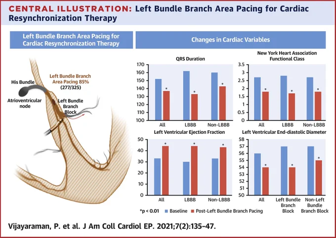 Vijayaraman, P. et al. J Am Coll Cardiol EP. 2021;7(2):135-47