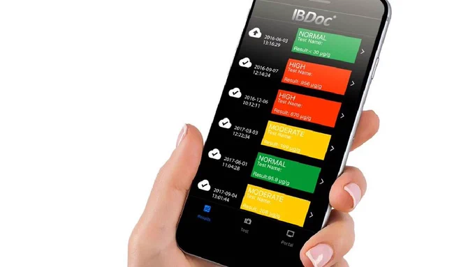 Smartphone with the IBD app running.