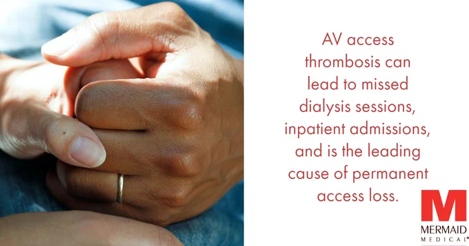 AV access thrombosis - complications in dialysis patients