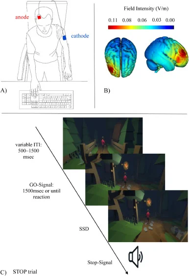 Fig. 2. A) Transcranial DC stimulation (tDCS) electrodes were positioned over F4 and left deltoid. B) DC flow during anodal stimulation using the HD-Explore software (Version 3.0, Soterix Medical Inc., New York, NY). The Montreal Neurological Institute and Hospital (MNI) 152 template was used for the magnetic resonance imaging (MRI) overlay. C) Exemplary, visual representation of a STOP trial in the context of the game.