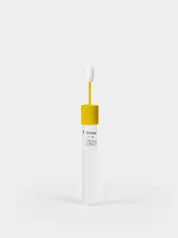Breakthrough: our new saliva swab enables fast and accurate concussion diagnosis.  https://bjsm.bmj.com/content/early/2021/02/09/bjsports-2020-103274