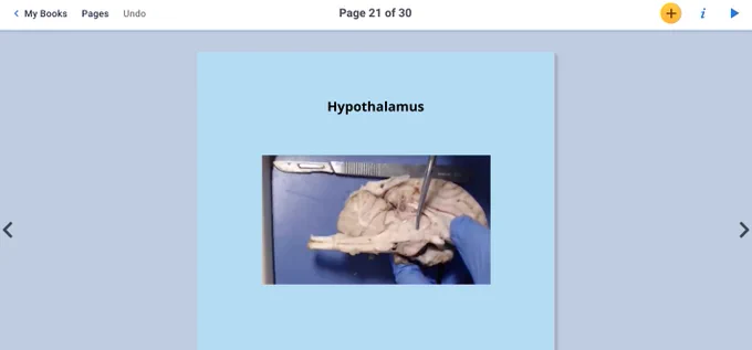bookcreator example of the hypothalamus of a sheep brain