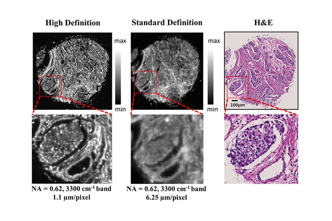 Comparisons of high definition and standard definition infrared imaging for digital histopathology
