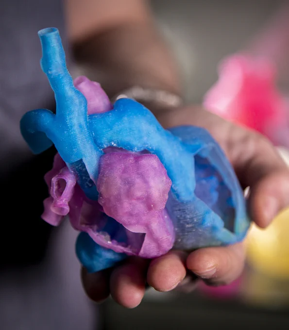 As part of a unique collaboration between the Duke Children’s Hospital and the Duke Innovation Co-Lab, 3D-printed hearts from patients' CT scans help cardiac surgeons visualize and plan a surgery to correct heart defects. Photo by Jared Lazarus.