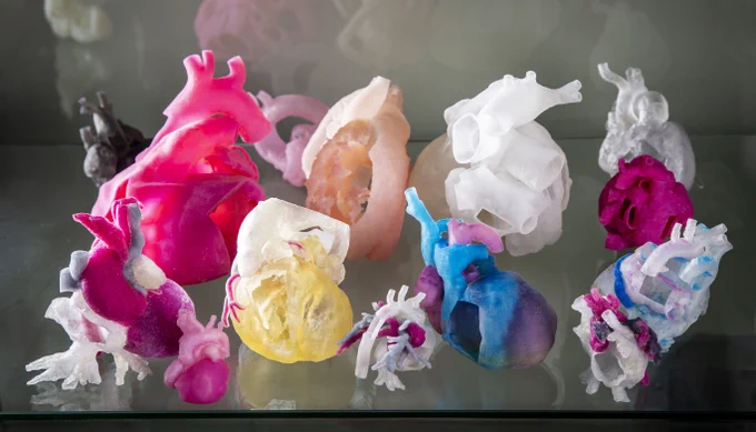 As part of a unique collaboration between the Duke Children’s Hospital and the Duke Innovation Co-Lab, 3D printed hearts from patients' CT scans help cardiac surgeons visualize and plan a surgery to correct heart defects. Photo by Jared Lazarus.
