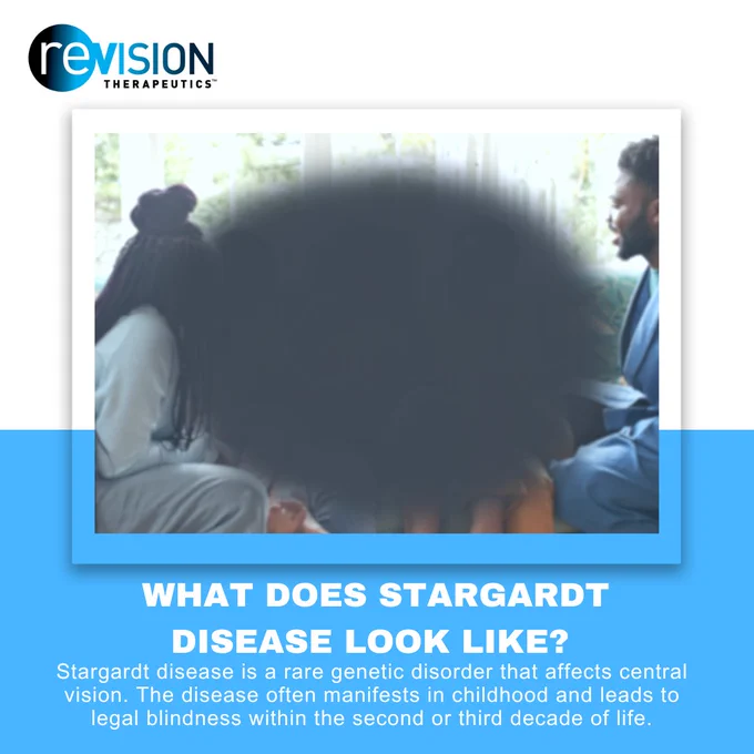 On a white and blue background, an interpretation of vision with Stargardt disease is displayed. The text says, “What Does Stargardt Disease Look Like? Stargardt disease is a rare genetic disorder that affects central vision. The disease often manifests in childhood and leads to legal blindness within the second or third decade of life.”