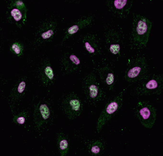 Microscopy image of human cells stained for macroH2A and DNA.