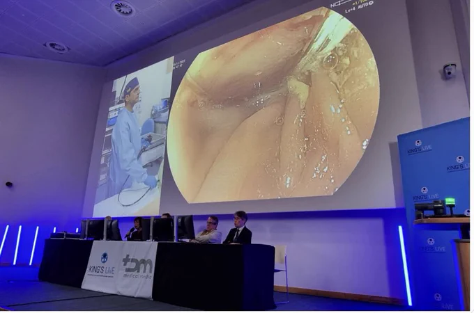 King’s Live 2023 is an annual endoscopy event that includes live demonstrations and presentations about the future direction of the specialty.