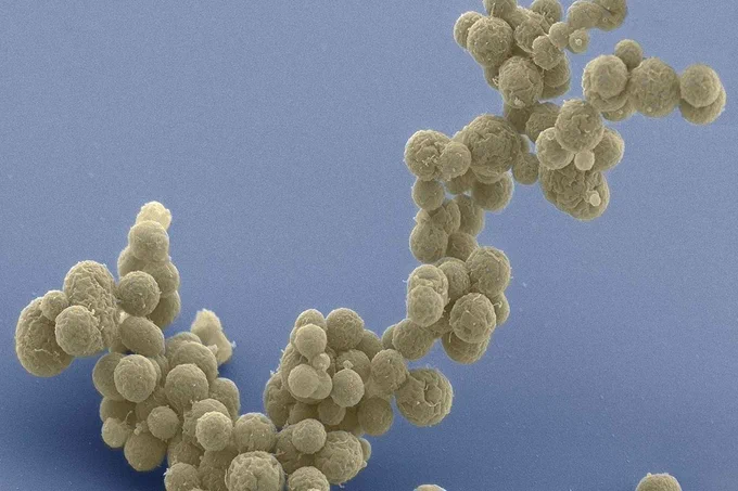 Electron micrographs of a cluster of minimal cells magnified 15,000 times. The synthetically streamlined bacterium, Mycoplasma mycoides, contains less than 500 genes. The images were made by Tom Deerinck and Mark Ellisman of the National Center for Imaging and Microscopy Research at the University of California at San Diego.