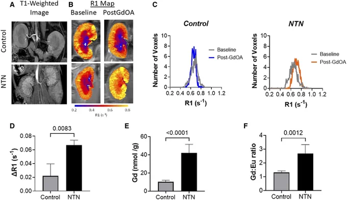 Gd-OA detects fibrogenesis in the NTN mouse model.