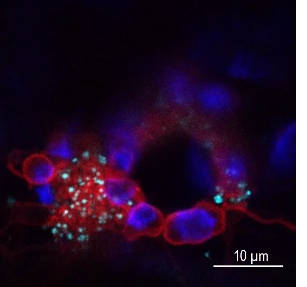 Accumulation de gouttelettes lipidiques dans les cellules végétales en réponse au virus TuMV (observation au microscope confocal). Les vésicules de réplication du virus sont marquées en rouge, les chloroplastes en bleu foncé et les gouttelettes lipidiques en bleu cyan. Echelle: 10 µm.