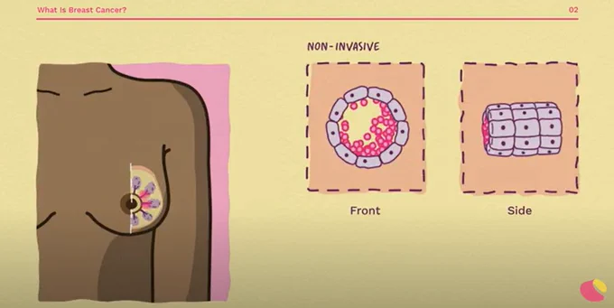 A still from one of our videos which shows a stylised design of a female breast