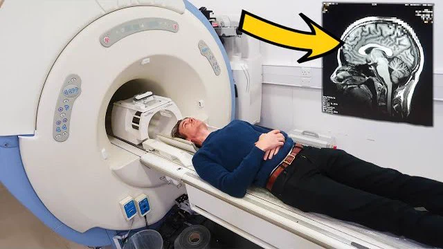 Joe Sugg getting ready for an MRI at Centre for Neuroimaging Sciences at King's IoPPN. Image taken from thumbnail of YouTube video.