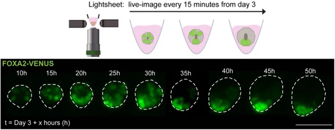 Top: schematic (created with BioRender) of timelapse imaging of double reporter on the Viventis lightsheet microscope. Full image stacks with 3 µm z step size were taken every 15 mins starting 6 hours post RA removal on Day 3 for 48-75 hours. Bottom: images from timelapse series of a NTO (maximum intensity z-projections) following the spatial organisation of FOXA2 (green) over 50 hours showing self-organisation from a dispersed (“salt-and-pepper”) into a clustered state. Dashed lines mark the outlines of the NTO. Scale bar, 100 µm.