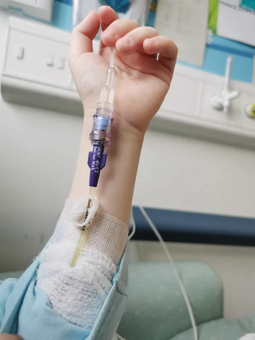 Chemotherapy infusion drip close up on canula
