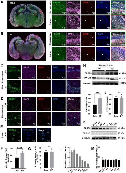 Localization and expression of CXCR5 in a C57BL/6J mouse and in brain tissue from patients with epilepsy. 