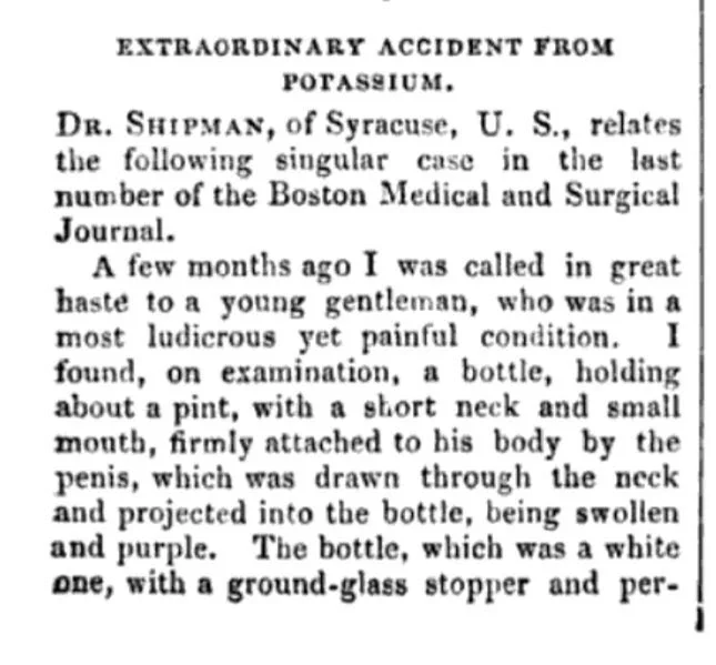 EXTRAORDINARY ACCIDENT FROM POTASSIUM. Dr. Shipman, of Syracuse, US, relates the following singular case in the last number of the Boston Medical and Surgical Journal. 

A few months ago, I was called in great haste to a young gentleman, who was in a most ludicrous, yet painful condition. I found, on examination, a bottle, holding about a pint, with a short neck and small mouth, firmly attached to his body by the penis, which was drawn through the neck and projected into the bottle, being swollen and purple. The bottle, which was a white one, with a ground glass stopper and…