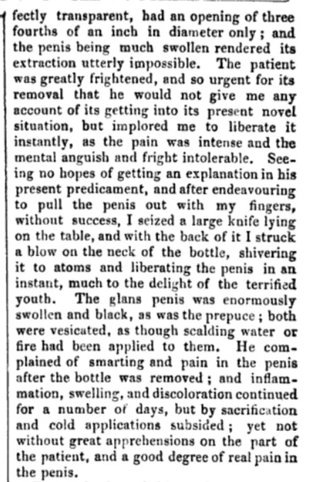 Perfect transparent, had an opening of three fourths of an inch in diameter only; and the penis being much swollen rendered it’s extraction utterly impossible. The patient was greatly frightened, and so urgent for it’s removal that he would not give me any account of it getting into its present novel situation, but implored me to liberate it instantly, as the pain was intense and the metal anguish and fright intolerable. Seeing no hope of getting an explanation in his present predicament, and after endeavouring to pull the penis out with my fingers, without success, I seized a large knife lying on the table, and with the back of it I struck a blow on the neck of the bottle, shivering it to atoms and liberating the penis in an instant, much to the delight of the terrified youth. The glans penis was enormously, swollen, and black, as was the prepuce, both were vesicated, as though scalding water  or fire had been applied to them.