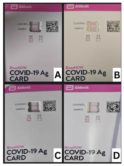 Unexpired and expired rapid antigen kits at various viral concentrations. (A) Unexpired 2.32 × 103 TCID50/mL (10× LOD). (B) Unexpired 2.32 × 102 TCID50/mL (LOD). (C) Expired 2.32 × 103 TCID50/mL (10× LOD). (D) Expired 2.32 × 102 TCID50/mL (LOD).