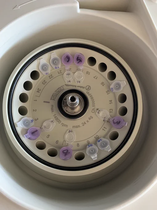 A picture of 11 tubes in the centrifuge which looked randomly inserted into different holes but the whole thing is perfectly balanced