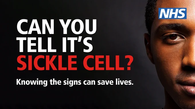Graphic saying: 'Can you tell it's sickle cell? Knowing the signs saves lives' with close-up photo of a young black man.