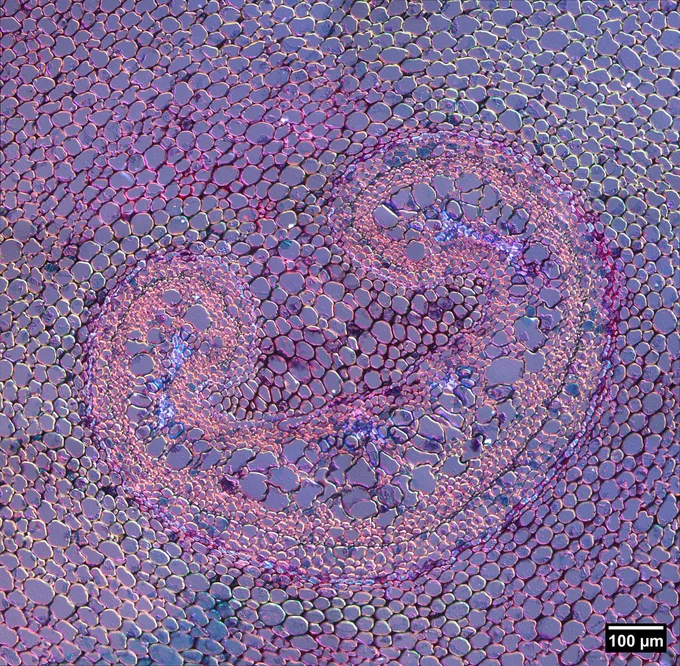 Image of a fern rhizome acquired with a 20X objective and K5C True Color Camera on a Leica Thunder with a DIC prism in the lightpath.