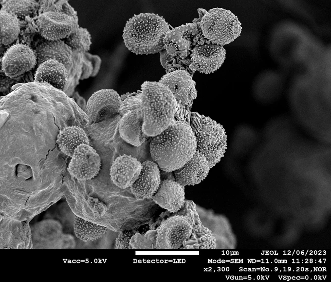 Secondary electron image of pollen grains attached to a bumblebee
